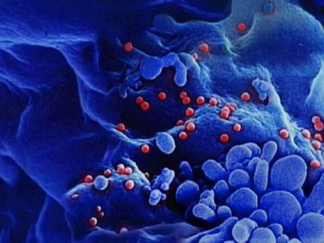 Aids: estudo anuncia êxito em 14 adultos, depois da cura de um bebê