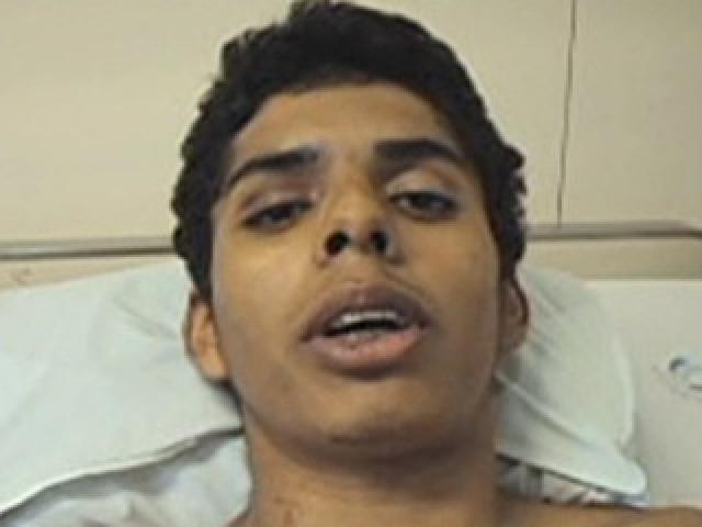 Ciclista que teve braço amputado diz que gostaria de perdoar atropelador