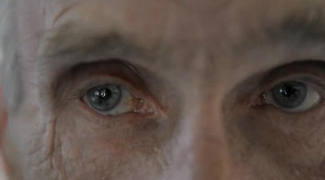 Acidente faz homem “cego” enxergar pela primeira em 66 anos