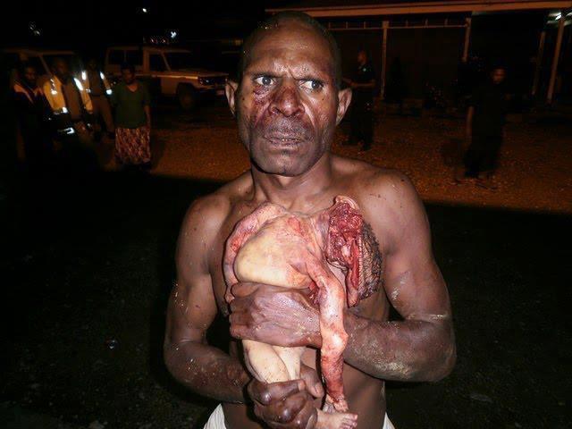 Homem come o próprio filho recém nascido
