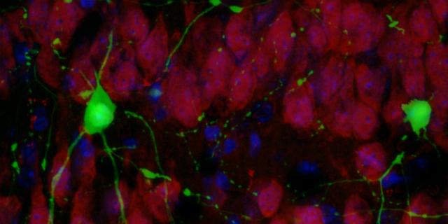 Cientistas revertem perda da memória provocada por Alzheimer