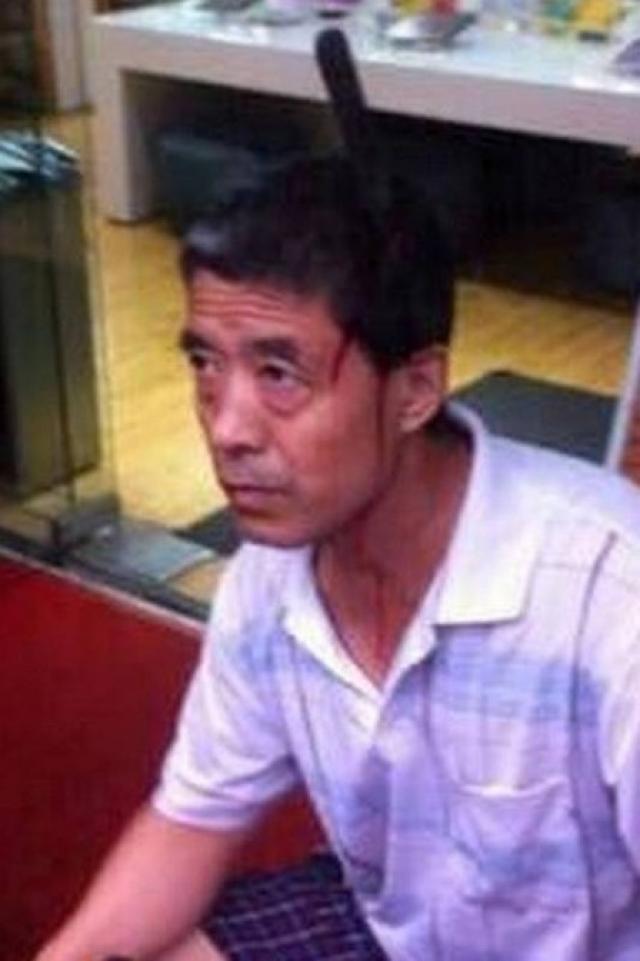 Faca cai do oitavo andar e acerta cabeça de chinês