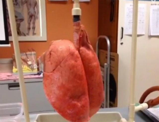 Vídeo: veja a diferença entre um pulmão saudável e o de um fumante