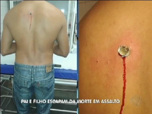 Pai e filho escapam da morte por milagre durante assalto em rodovia