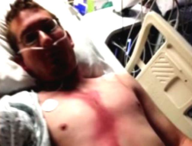 Homem sobrevive após raio atravessar seu corpo