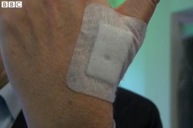 Escritório sueco troca crachás por chips implantados sob a pele de funcionários