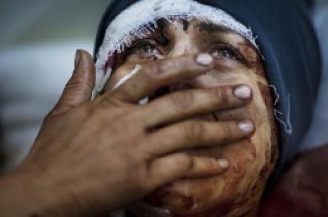 Mulher é queimada por não aceitar se casar com muçulmano
