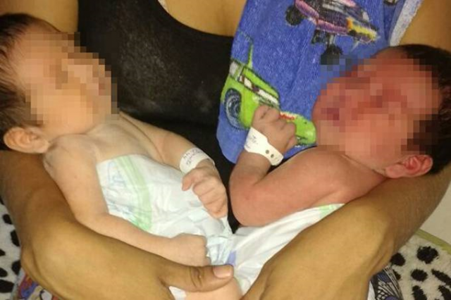 Gêmos indígenas escapam da morte no Pará