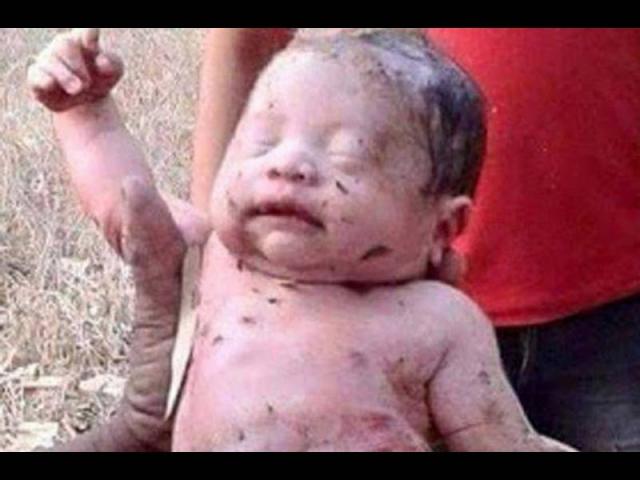 Bebê-milagre! Após 14 facadas e enterrado vivo pela própria mãe, ele sobreviveu!