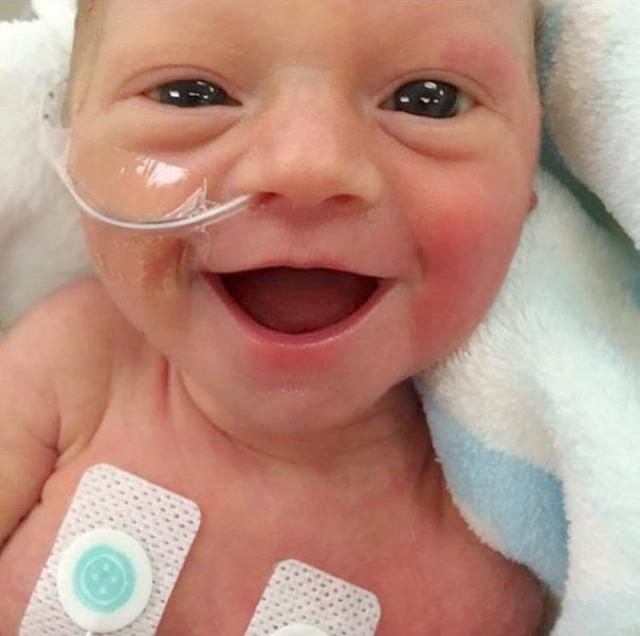 Sorrisão de bebê prematura de apenas cinco dias está encantando a web