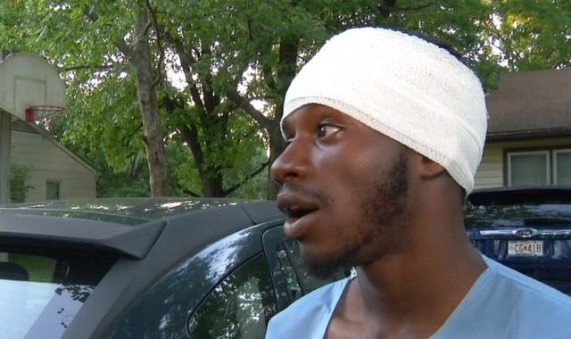Homem livra pastor de ataque e sobrevive a tiro na cabeça: “Anjos estavam comigo”