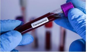 É Fake ! Cuba não criou vacina contra o coronavírus –